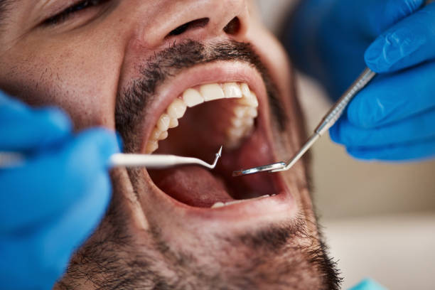Best Oral Cancer Screening  in Walker Mill, MD